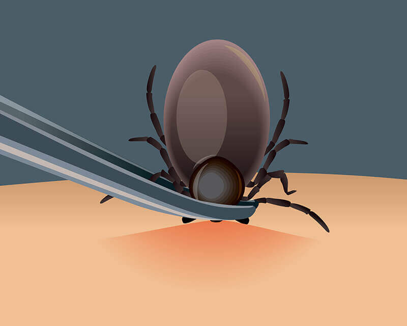 traitement de la maladie de Lyme