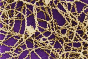 La bactérie à l'origine de la leptospirose chez les chats