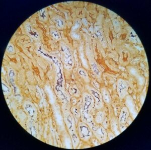 La bactérie provoquant la leptospirose chez les chats vue au microscope