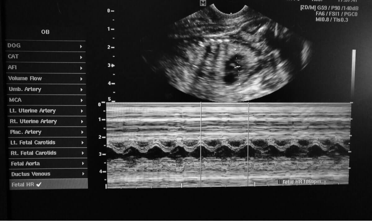 Chiens épileptiques.